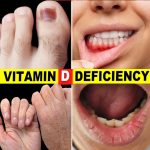 10 Signs Your Body Is Begging for Vitamin D