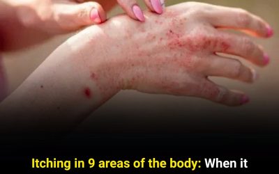9 Types of Body Itching That May Indicate Serious Health Issues