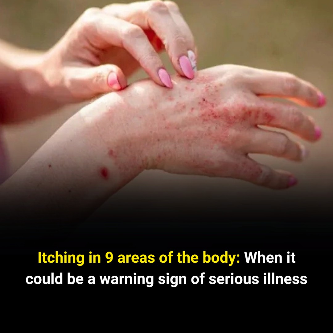 9 Types of Body Itching That May Indicate Serious Health Issues