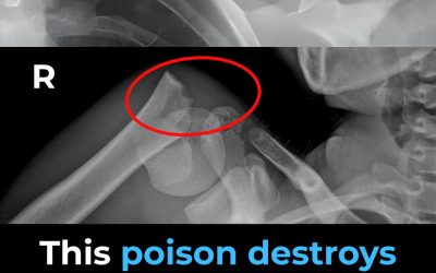This Drink Will Destroy Your Bones From The Inside But Everyone Drinks It Anyway