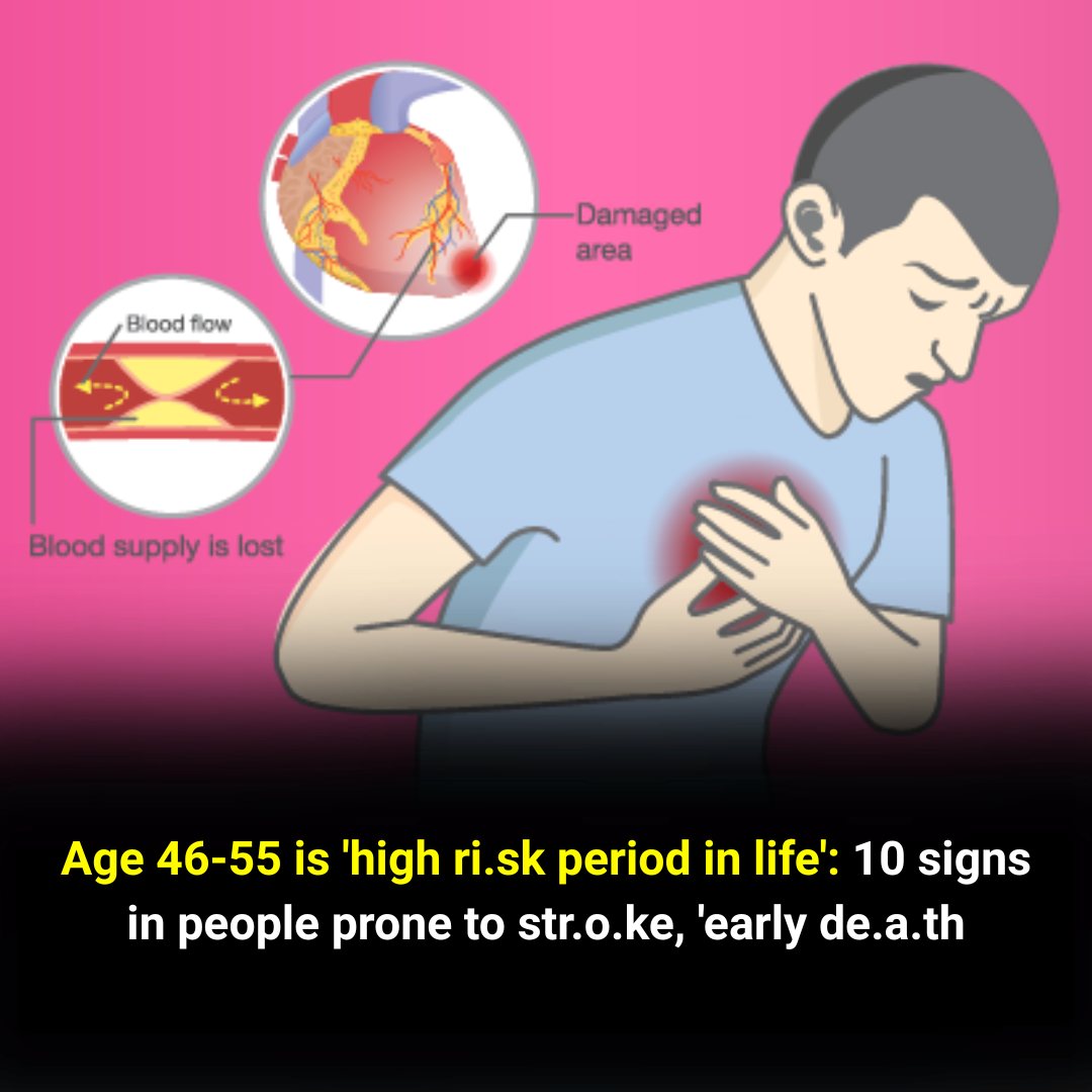 Watch for These 10 Signs Linked to Stroke Risk and Early Mor:tality