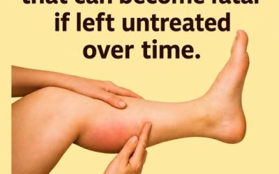 The 6 Best Herbal Infusions to Help Keep Your Arteries Healthy Naturally