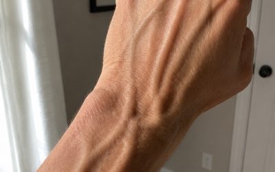 If Your Hand Veins Are Bulging or More Noticeable, Don’t Ignore These Possible Causes