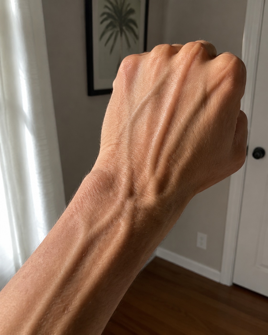 If Your Hand Veins Are Bulging or More Noticeable, Don’t Ignore These Possible Causes