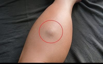 Why Do You Get Leg Cramps at Night? 8 Surprising Triggers and Easy Habits to Explore