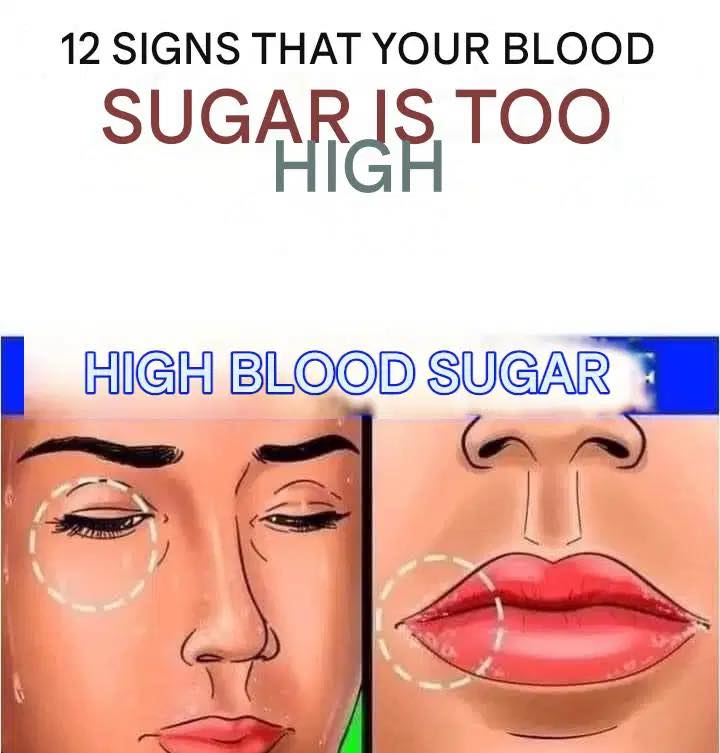 The High-Sugar Alert: Recognizing the 12 Key Symptoms Your Body is Showing You.