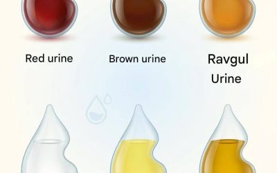 What does the color of your urine say about your health?