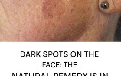 Add it to your cream and blemishes on your face will be a distant memory.
