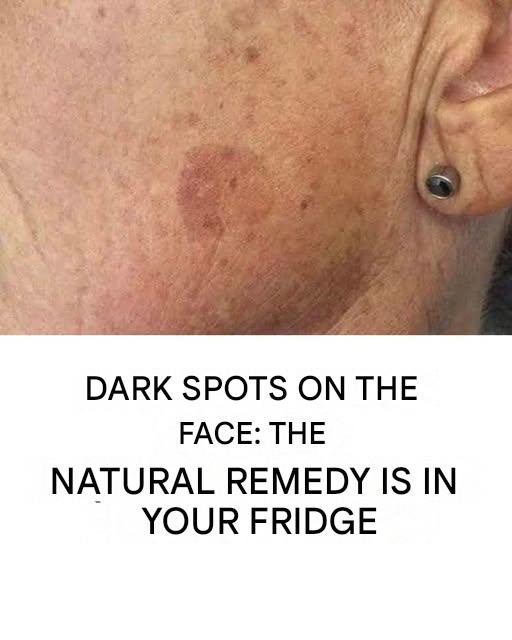 Add it to your cream and blemishes on your face will be a distant memory.