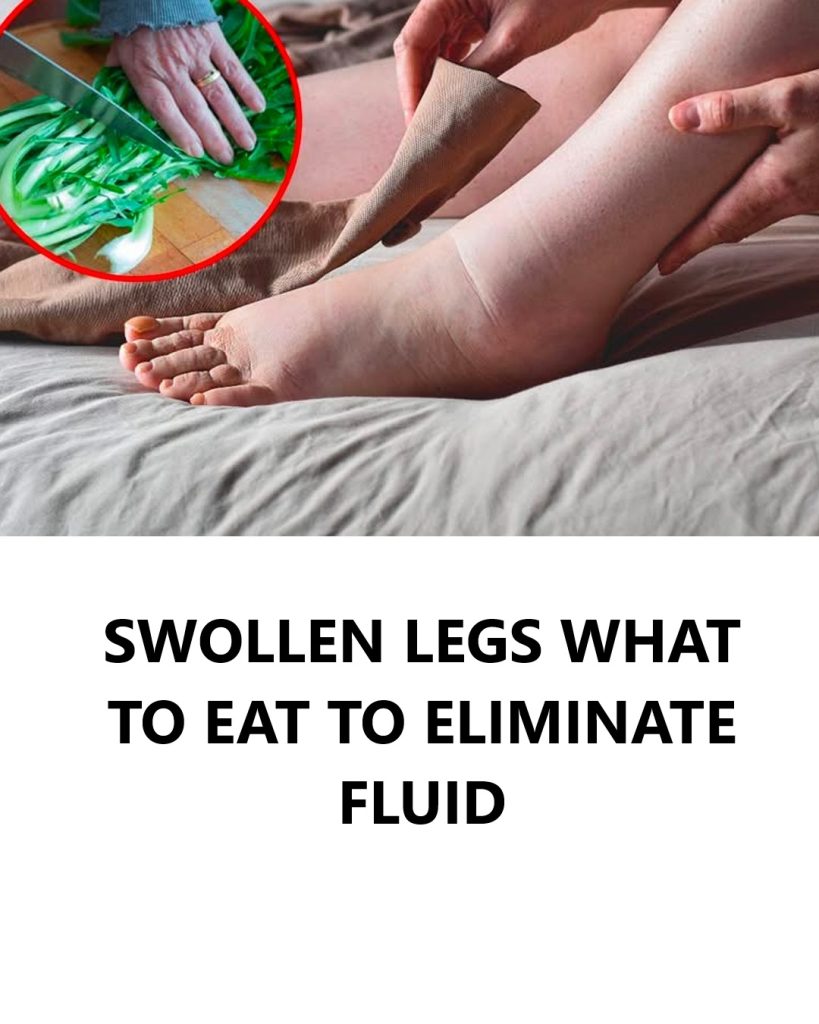 Water Retention: What Causes It and How to Eliminate It