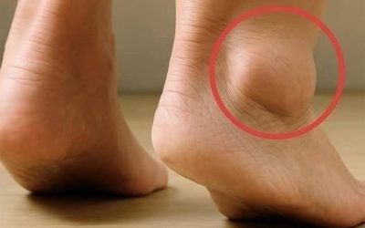 If your feet swell, it is a clear sign that…See more