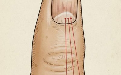 If you have these lines on your nails, you should pay attention.