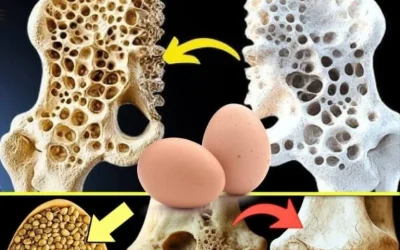 1 Foods that Improve Your Weak Bones (How to Consume Them)